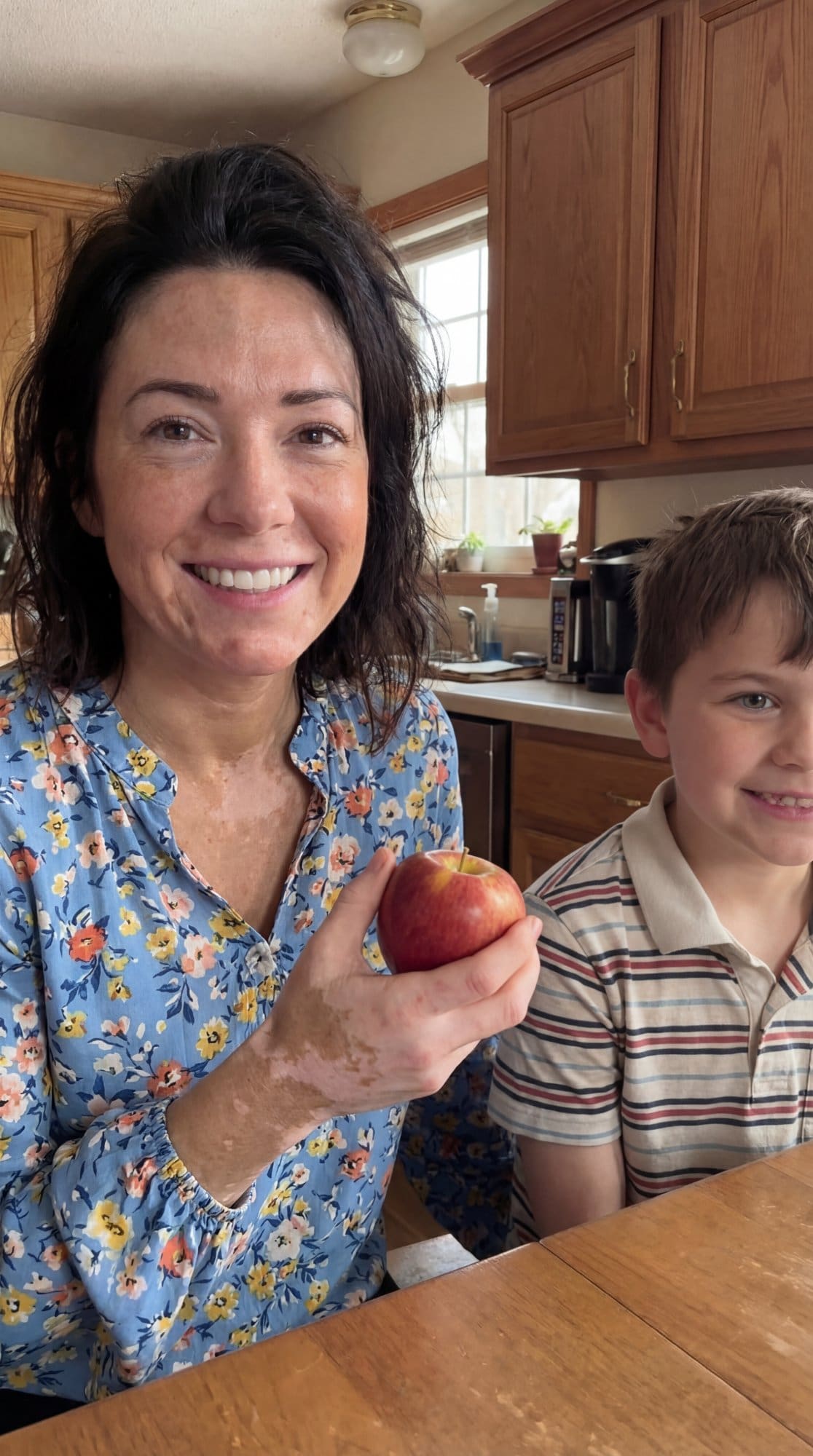 Mother with vitiligo and child in kitchen - AI inclusive family